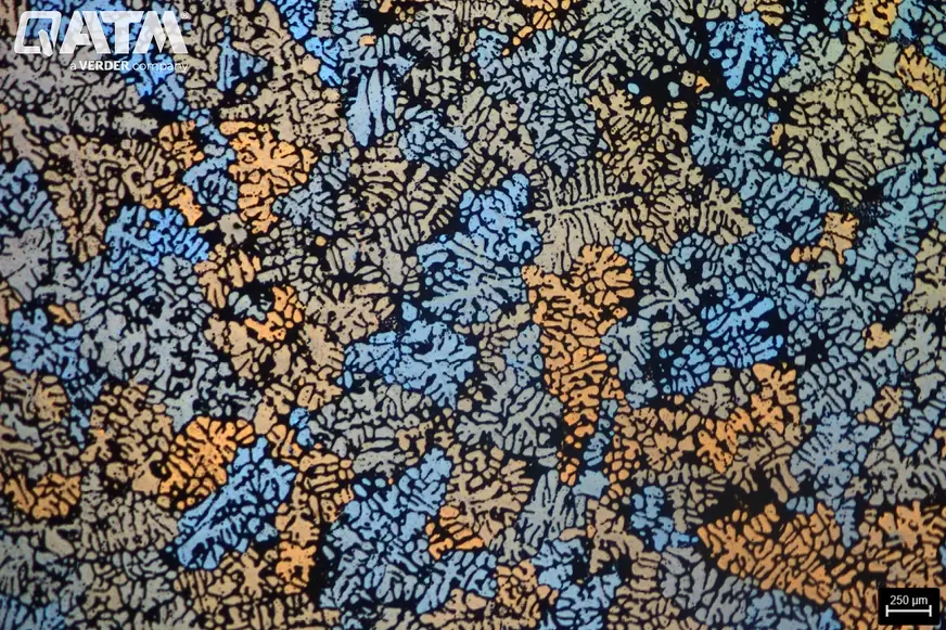 llknowledgebasealuminummetallographyextendedcastingalualloygpcaption5